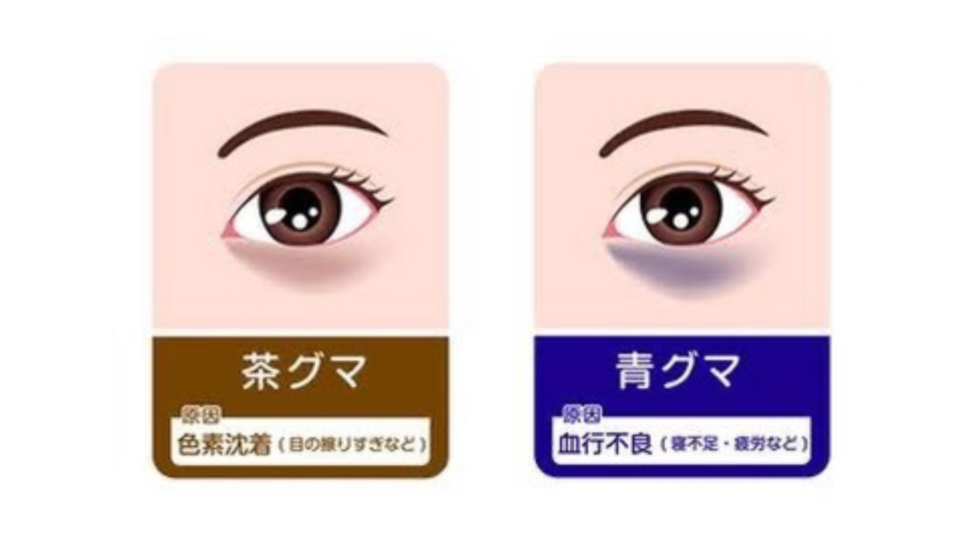 東京都港区南麻布美容鍼灸サロンCINQ 美容鍼でクマ改善 美容鍼でコラーゲンを生成する 美容鍼で目の疲れを改善